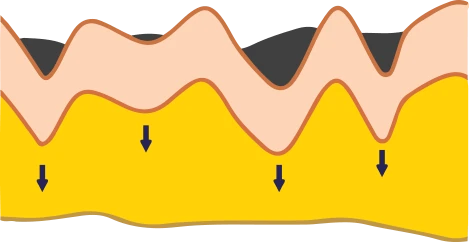 Grafico: effetti dei cosmetici topici