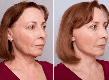 Cliente soddisfatta con Crema Elesse