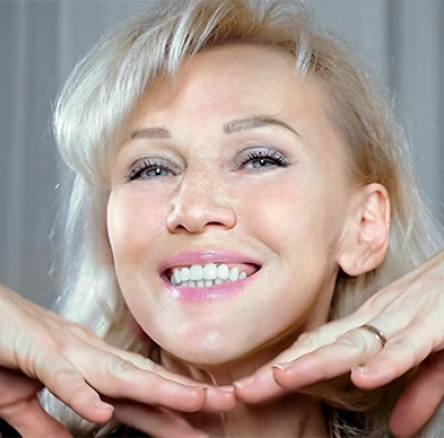 Donna dopo 28 giorni con Retilift: pelle ringiovanita, meno rughe