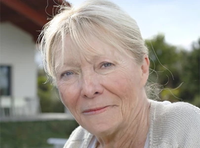 Alice prima di iniziare il trattamento anti-età Retilift